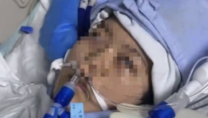 22岁美甲师手术成功却在复苏室脑死亡，家属称缺氧30分钟监护医生未察觉，医院回应