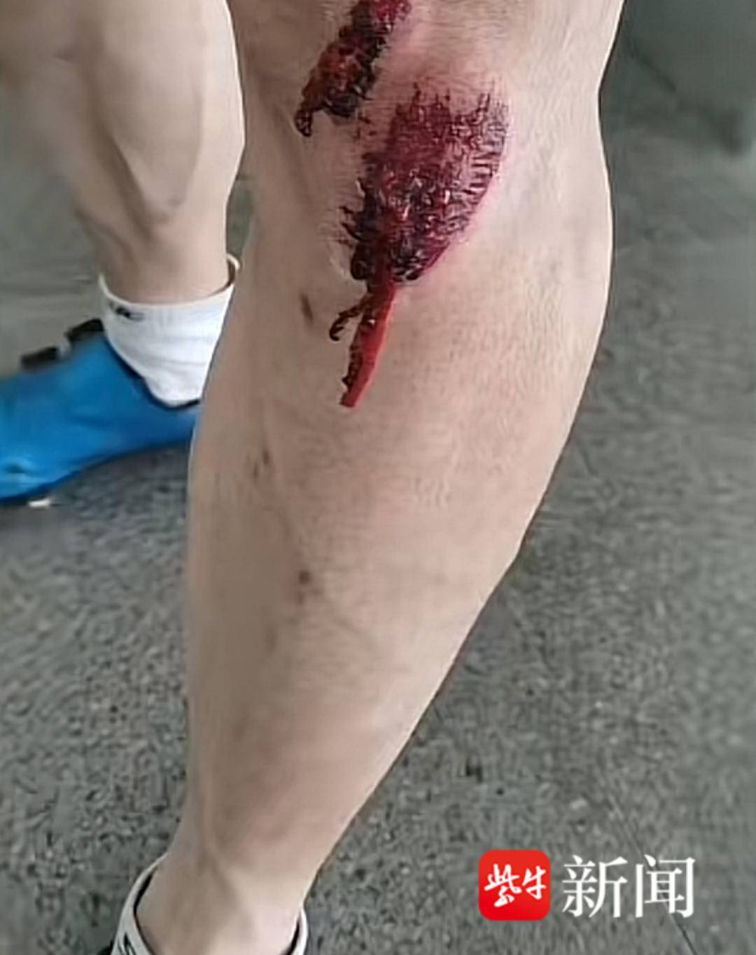 紫牛头条| 安徽一自行车赛摔车事故致多名车手受伤，业内人士呼吁推行分级分组比赛